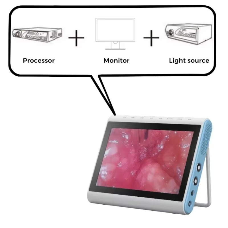 معالج مصدر ضوء للتصوير الطبي ب - مراجعة Medical Lab Images وسعره