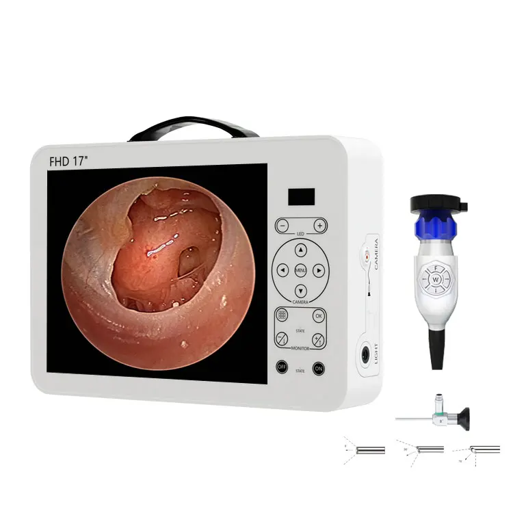 مجموعة نظام تشخيص الأنف والأذن - مراجعة Medical Lab Images وسعره